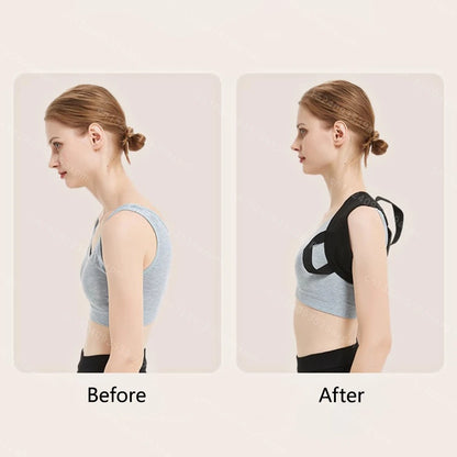 NestlyCozy™ Back Posture Corrector